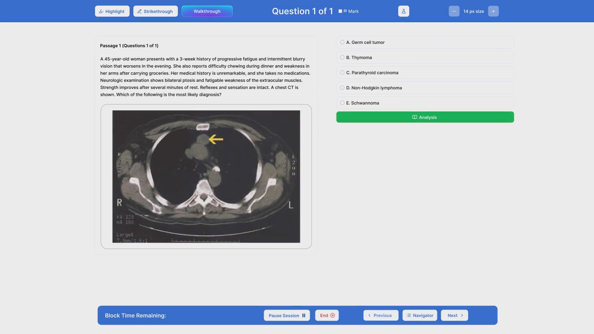 Load video: Step 2CK Question Bank